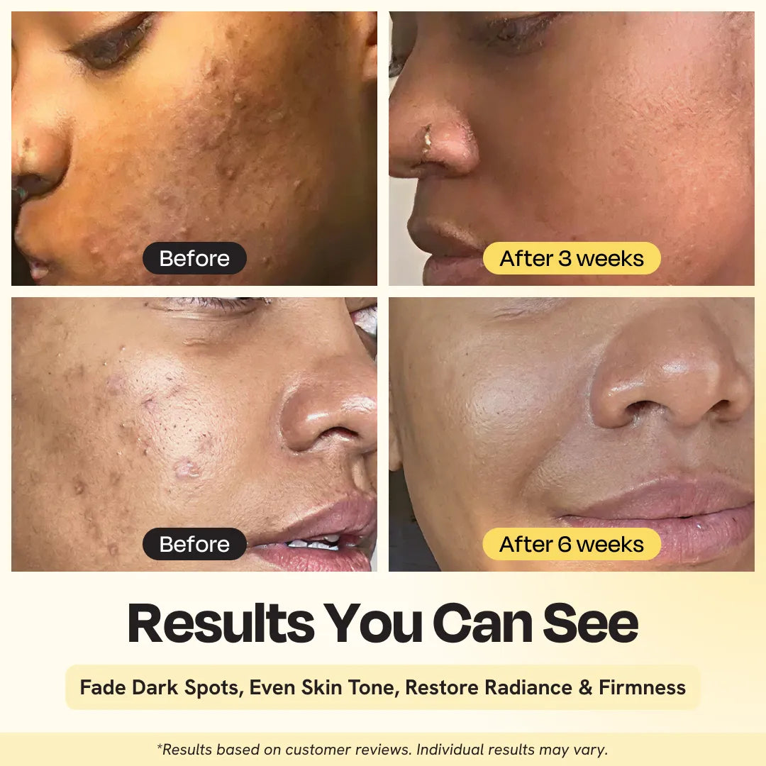 Dark Spot Heroes
